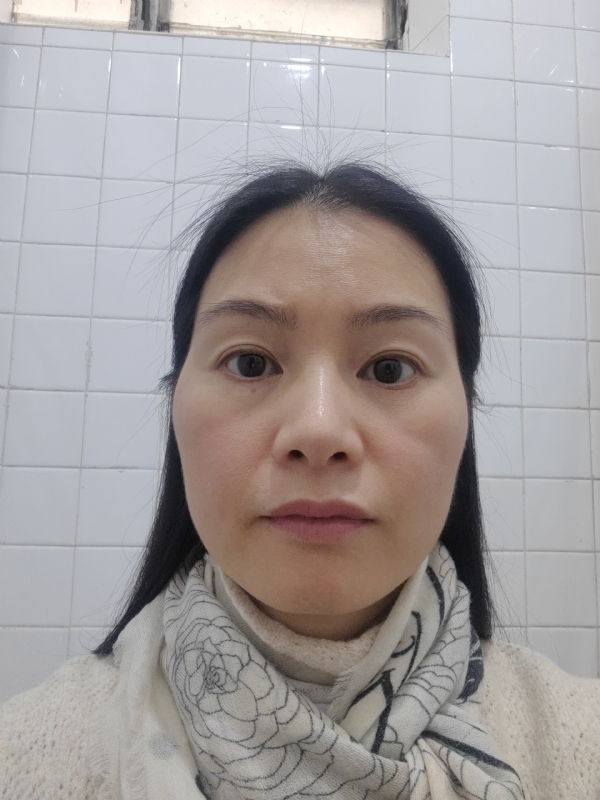 罌粟花的第一张照片--香港残疾人相亲网